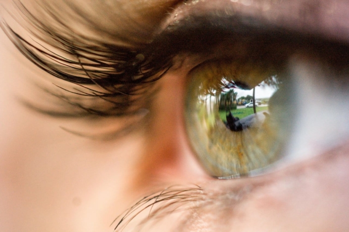 femtolaser laser a femtosecondi CAMO Centro Ambrosiano Oftalmico