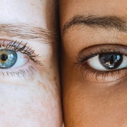 intervento di blefaroplastica - CAMO - Centro Ambrosiano Oftalmico