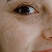 difetti visivi elevati - CAMO - Centro Ambrosiano Oftalmico