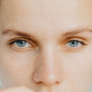 oculoplastica prima e dopo - CAMO - Centro Ambrosiano Oftalmico